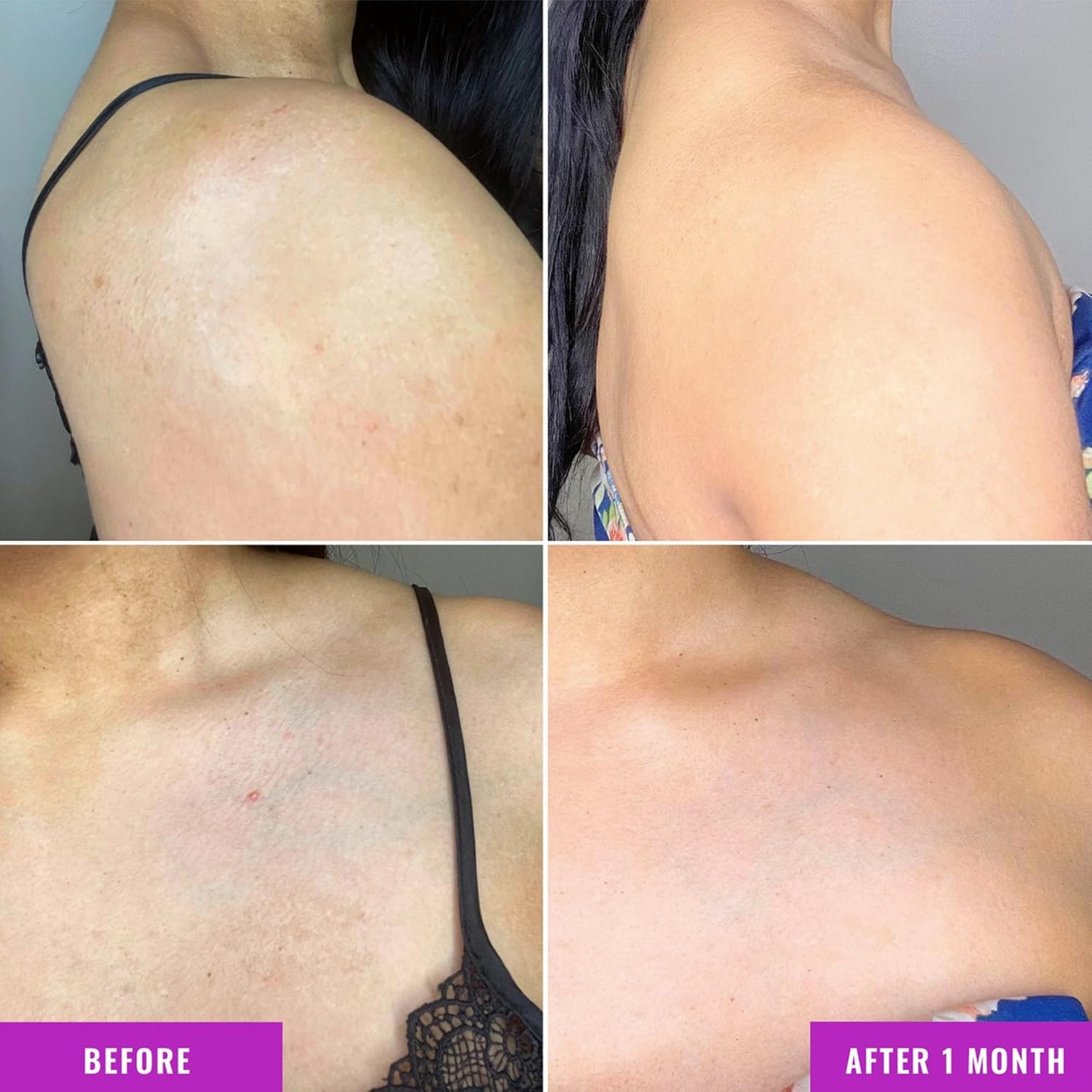 Good Molecules Hyperpigmentation Face & Body Duo *Envío Gratis*