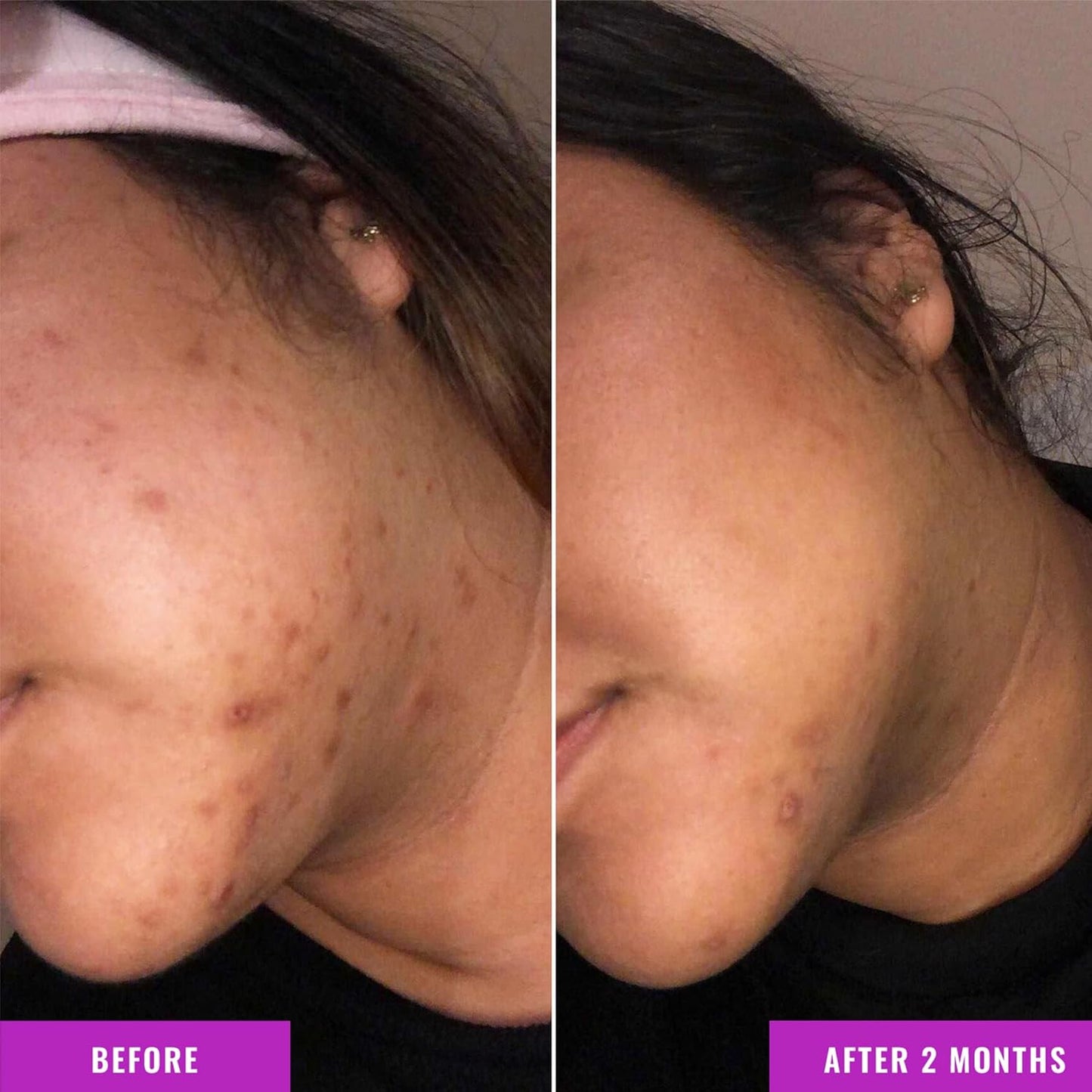 Good Molecules Hyperpigmentation Face & Body Duo *Envío Gratis*
