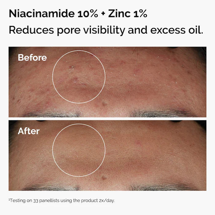 The Ordinary The Skin Support Set con Niacinamida + Ácido Hialurónico