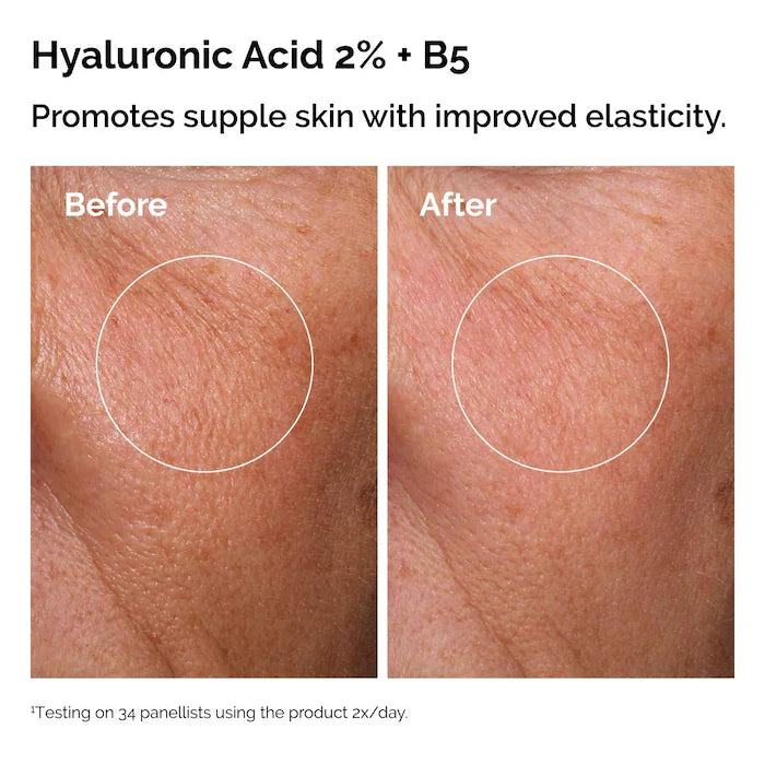 The Ordinary The Skin Support Set con Niacinamida + Ácido Hialurónico